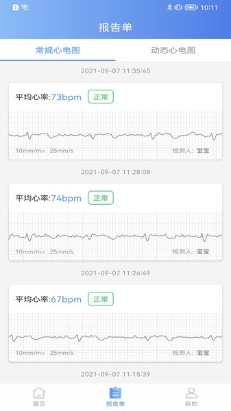 卡帕奇心电app下载-卡帕奇心电记录仪下载v4.0.13 安卓版 运行截图3